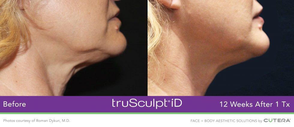 truscupt-id-roman-dykun-md-1-1-980x425_orig