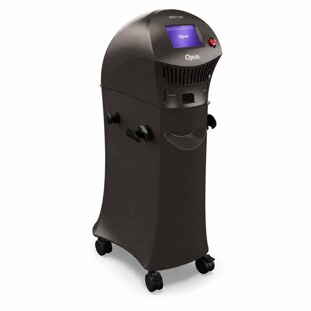 Alma Opus skin resurfacing device used for advanced microplasma skin treatment
